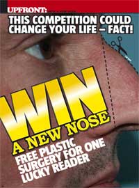 Front magazine UK nose plastic surgery
