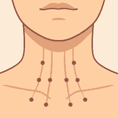 βοτοχ για λαιμό