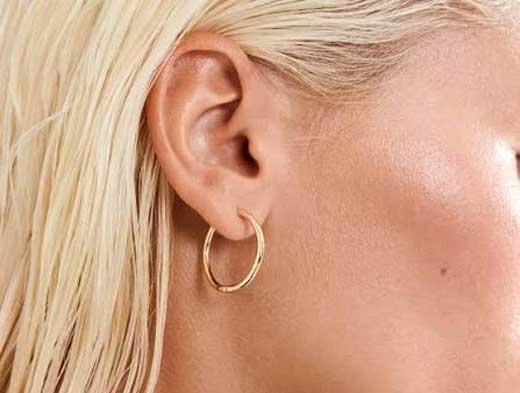 otoplasty