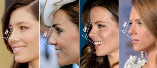 rhinoplasty