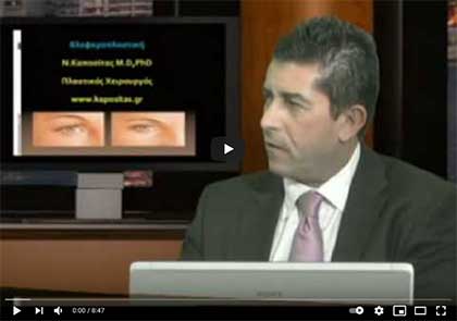 βλεφαροπλαστική